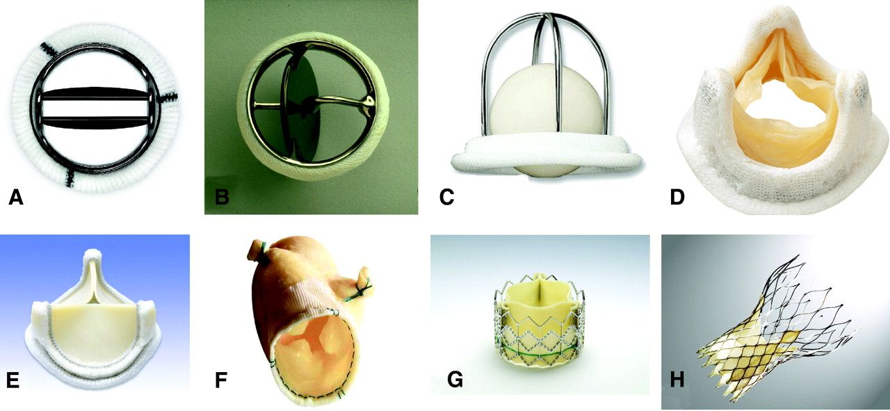 prosthetic heart valves market