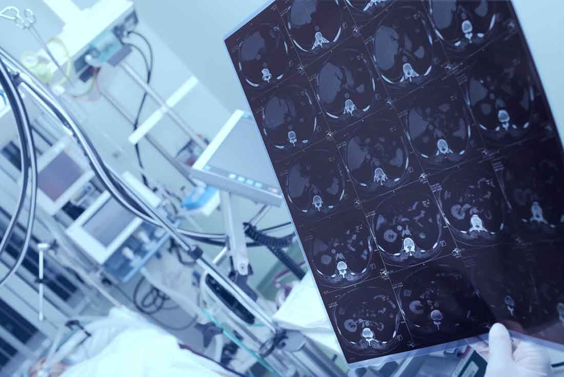 Nordamerika Markt für medizinische Bildanalyse-Software