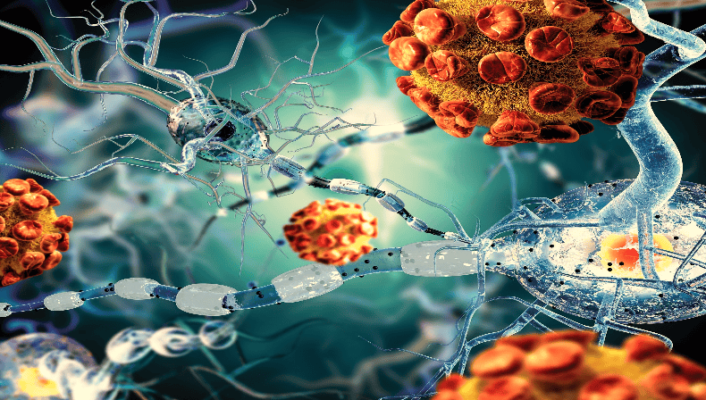 Myasthenia Gravis (MG)