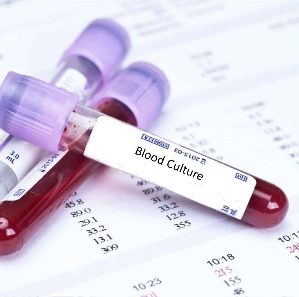 Blood Culture Tests Market