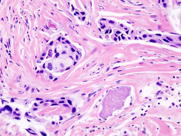 Anatomic Pathology Market
