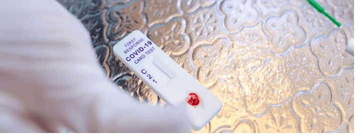 Mercado de Ensayos de Flujo Lateral