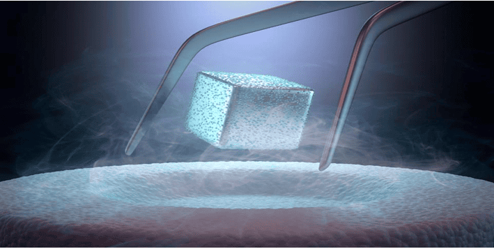 Superconductors Market