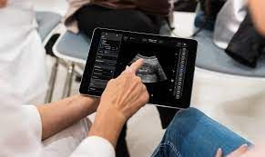 Point-of-Care Ultrasound Device Market
