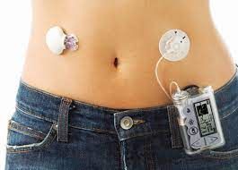 Artificial Pancreas Device Systems Market