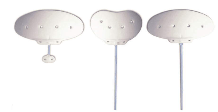 Glaucoma Drainage Devices Market