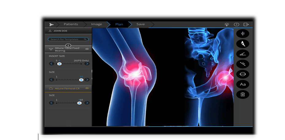 Orthopedic Software Market