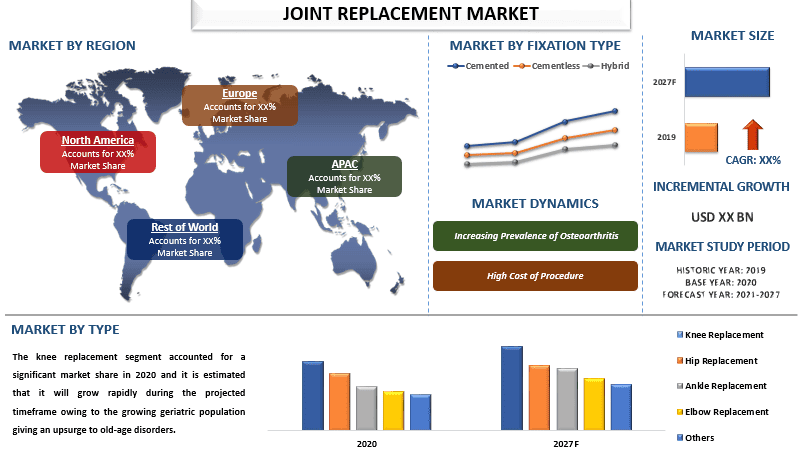 Joint Replacement Market